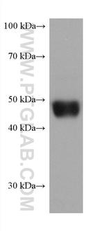 PRAME Antibody in Western Blot (WB)