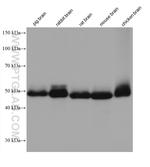 PACSIN1 Antibody in Western Blot (WB)