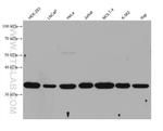 BNIP3L Antibody in Western Blot (WB)