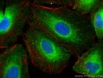 REEP5 Antibody in Immunocytochemistry (ICC/IF)