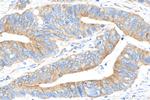 REEP5 Antibody in Immunohistochemistry (Paraffin) (IHC (P))