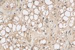 RAP1A Antibody in Immunohistochemistry (Paraffin) (IHC (P))