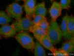RBP5 Antibody in Immunocytochemistry (ICC/IF)
