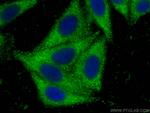 RBP5 Antibody in Immunocytochemistry (ICC/IF)