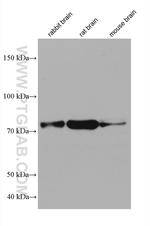 PFKP Antibody in Western Blot (WB)