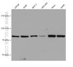 PFKP Antibody in Western Blot (WB)