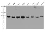 MYDGF/C19orf10 Antibody in Western Blot (WB)