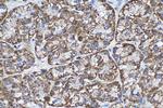 ECH1 Antibody in Immunohistochemistry (Paraffin) (IHC (P))