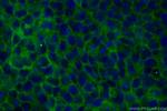 TACSTD2/TROP2 Antibody in Immunocytochemistry (ICC/IF)