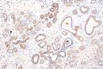 TACSTD2/TROP2 Antibody in Immunohistochemistry (Paraffin) (IHC (P))