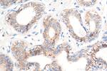 TACSTD2/TROP2 Antibody in Immunohistochemistry (Paraffin) (IHC (P))