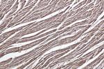 MYL6 Antibody in Immunohistochemistry (Paraffin) (IHC (P))