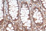 MYL6 Antibody in Immunohistochemistry (Paraffin) (IHC (P))