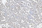 NDUFV1 Antibody in Immunohistochemistry (Paraffin) (IHC (P))