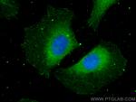 HBS1L Antibody in Immunocytochemistry (ICC/IF)