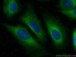 HBS1L Antibody in Immunocytochemistry (ICC/IF)