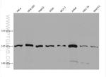 WNK1 Antibody in Western Blot (WB)