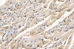 NDUFV2 Antibody in Immunohistochemistry (Paraffin) (IHC (P))