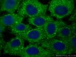 AIDA Antibody in Immunocytochemistry (ICC/IF)