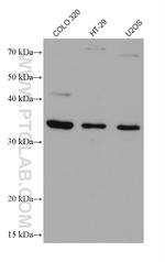AIDA Antibody in Western Blot (WB)