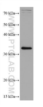 AIDA Antibody in Western Blot (WB)
