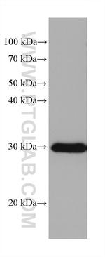 DDAH2 Antibody in Western Blot (WB)
