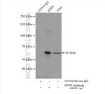 STIP1 Antibody in Immunoprecipitation (IP)