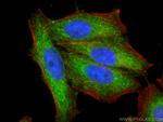 HIBCH Antibody in Immunocytochemistry (ICC/IF)