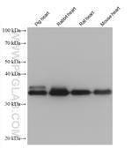 TPM3 Antibody in Western Blot (WB)