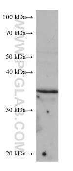 TPM3 Antibody in Western Blot (WB)