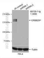ERBB2IP Antibody in Western Blot (WB)