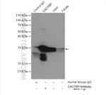 CACYBP Antibody in Immunoprecipitation (IP)
