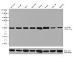 CACYBP Antibody in Western Blot (WB)