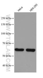 MRPP3 Antibody in Western Blot (WB)