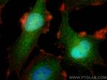 NIT2 Antibody in Immunocytochemistry (ICC/IF)