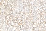 NIT2 Antibody in Immunohistochemistry (Paraffin) (IHC (P))