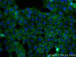 PSMB2 Antibody in Immunocytochemistry (ICC/IF)