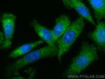PSMB2 Antibody in Immunocytochemistry (ICC/IF)