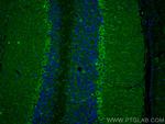 COMT Antibody in Immunohistochemistry (PFA fixed) (IHC (PFA))