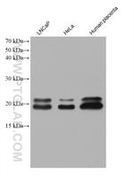 ARL8A/ARL8B Antibody in Western Blot (WB)