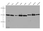 RPAP1 Antibody in Western Blot (WB)