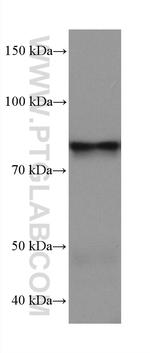 APPL1 Antibody in Western Blot (WB)