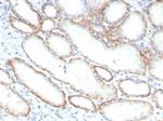 CD147/EMMPRIN/Neurothelin Monoclonal Antibody (BSG/7950)