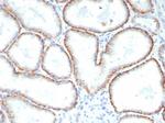 CD147/EMMPRIN/Neurothelin Monoclonal Antibody (BSG/7952)
