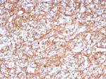 CD147/EMMPRIN/Neurothelin Monoclonal Antibody (BSG/7954)