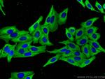 CAP1 Antibody in Immunocytochemistry (ICC/IF)