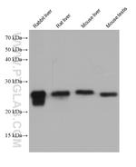 GSTM5 Antibody in Western Blot (WB)