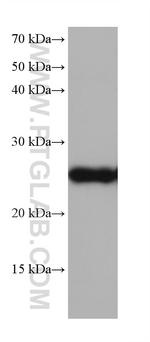 GSTM5 Antibody in Western Blot (WB)