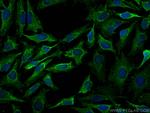 NOTCH2/NOTCH2NL Antibody in Immunocytochemistry (ICC/IF)