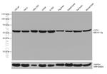 CCT2 Antibody in Western Blot (WB)